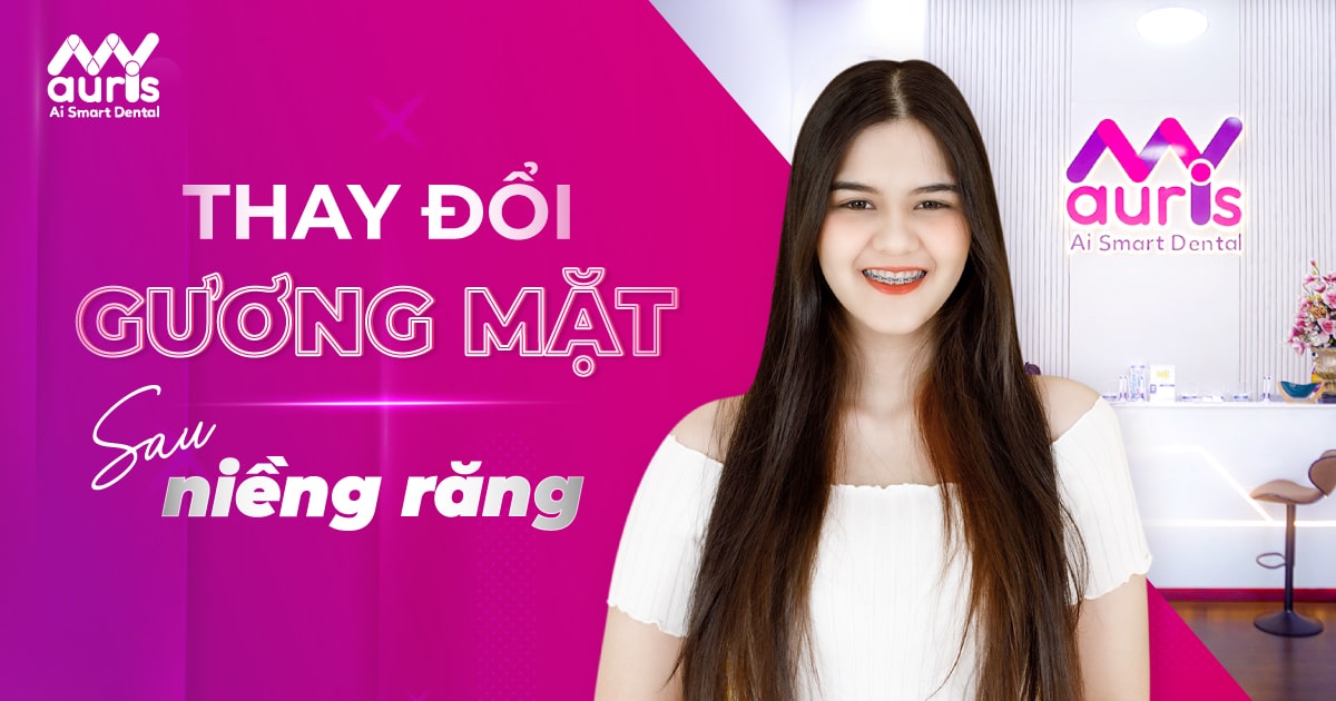 Thay đổi gương mặt sau khi niềng răng - Theo 4 trường hợp