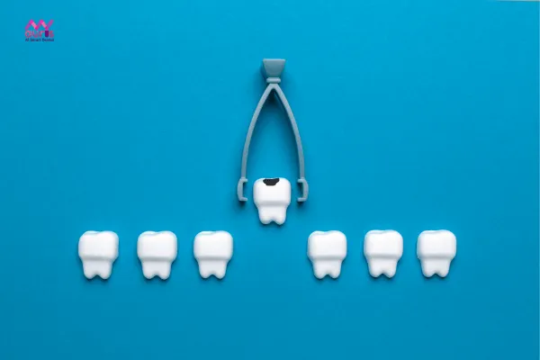 Thời gian làm răng giả sau khi nhổ là bao lâu? 