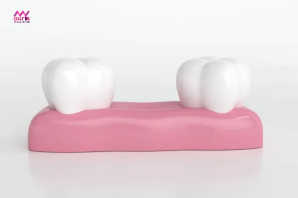 Làm răng giả sau khi nhổ có nên không? 