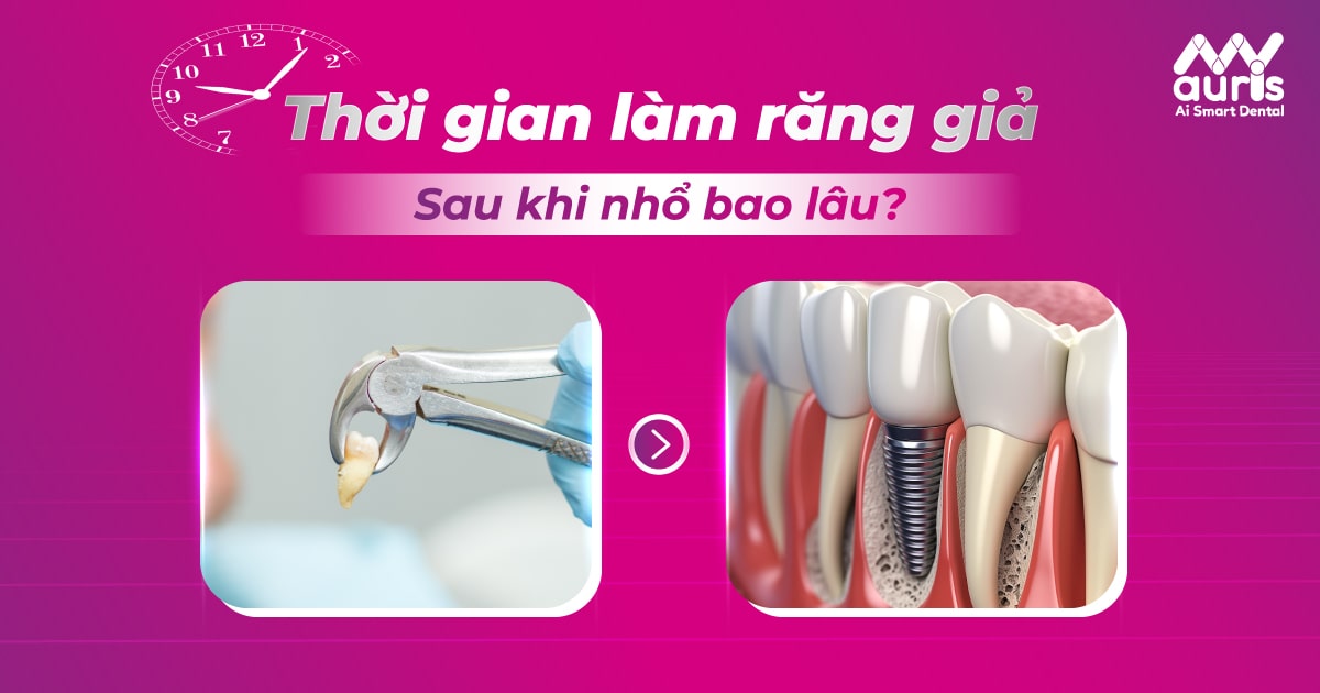 Thời gian làm răng giả sau khi nhổ bao lâu?