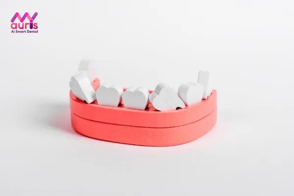 Giải đáp có nên tiến hành nhổ răng cửa mọc lệch và trồng răng cửa bị lệch không?