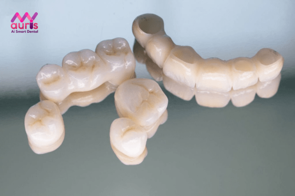 Phương pháp phục hình răng bằng cầu răng sứ