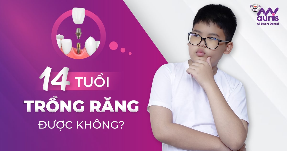 14 tuổi TRỒNG RĂNG được không? Giải đáp nha khoa