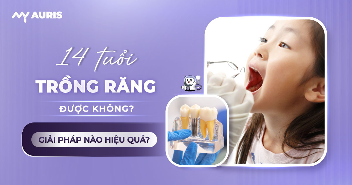 14 tuổi trồng răng được không
