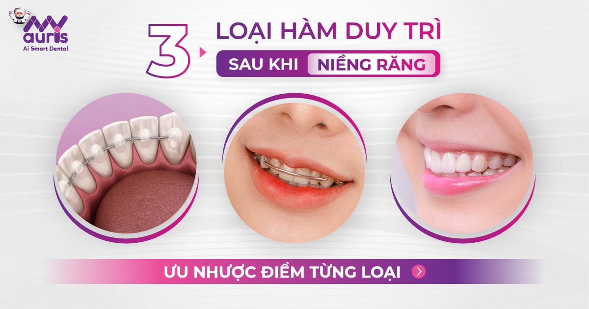 3 loại hàm duy trì sau khi niềng răng