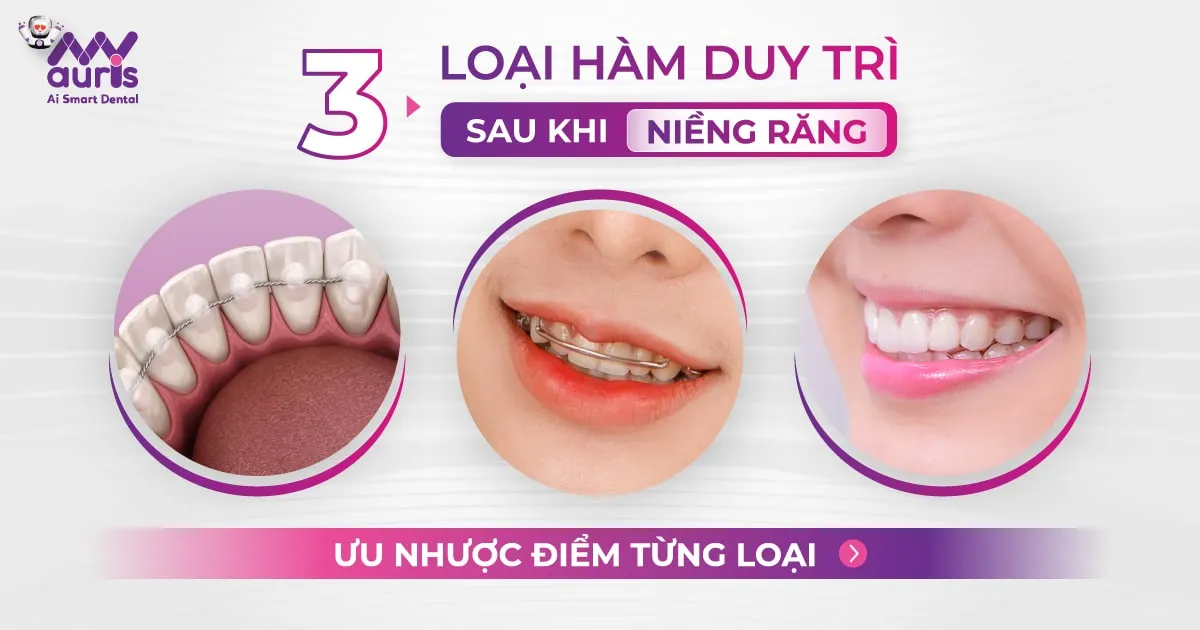 3 loại hàm duy trì sau khi niềng răng