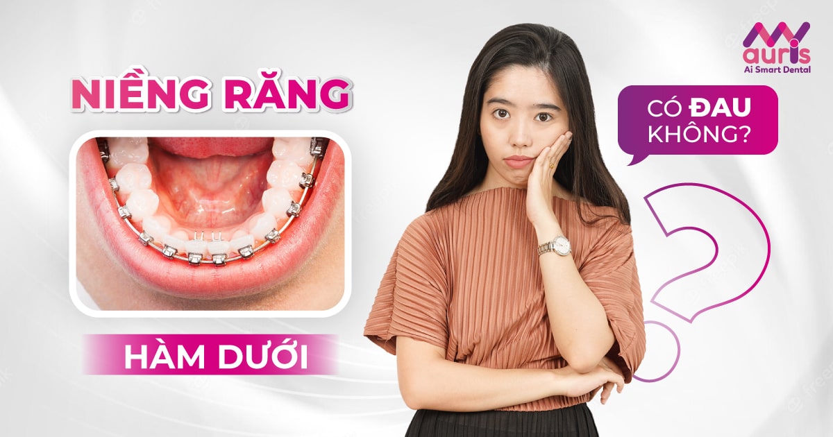 niềng răng hàm dưới có đau không