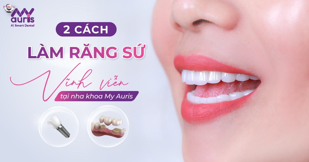 cách làm răng sứ vĩnh viễn