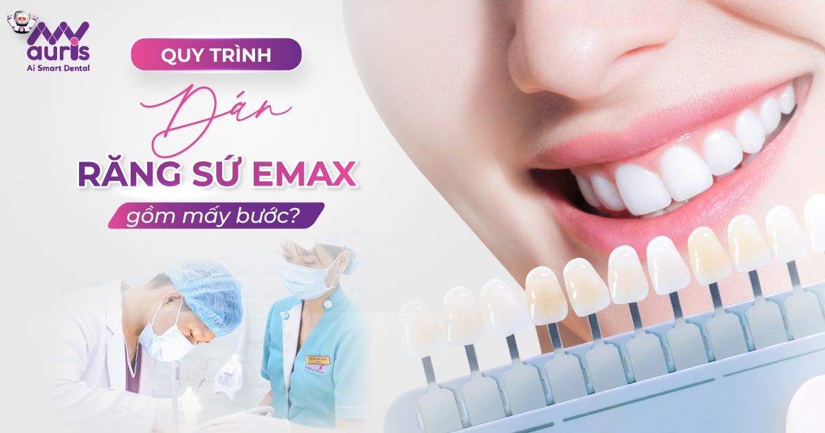 dán răng sứ emax