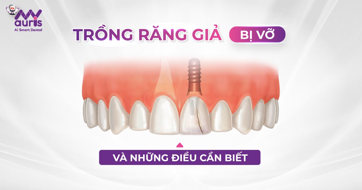 trồng răng giả bị vỡ