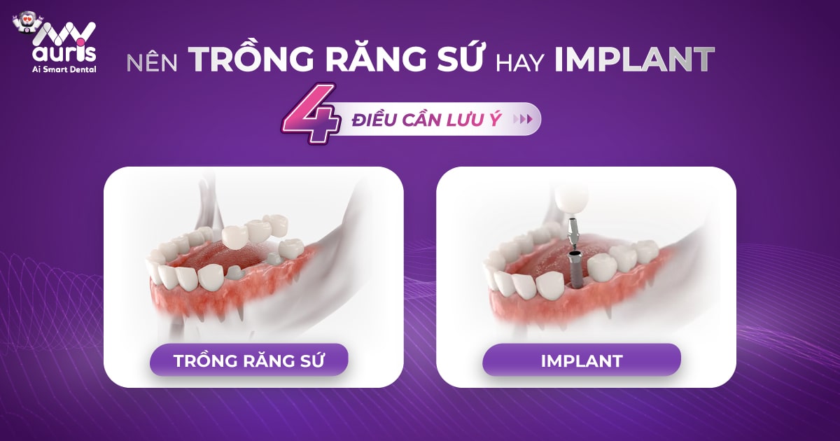 nên trồng răng sứ hay implant