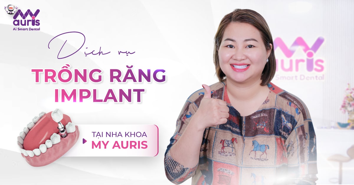 dịch vụ trồng răng implant