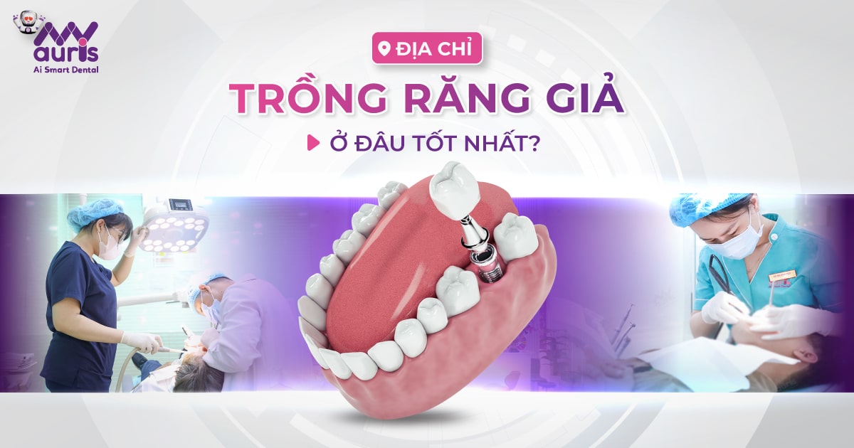 trồng răng giả ở đâu tốt nhất