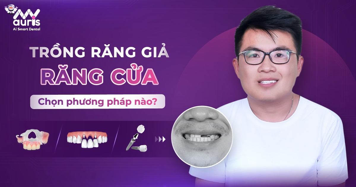 trồng răng giả uy tín ở đâu