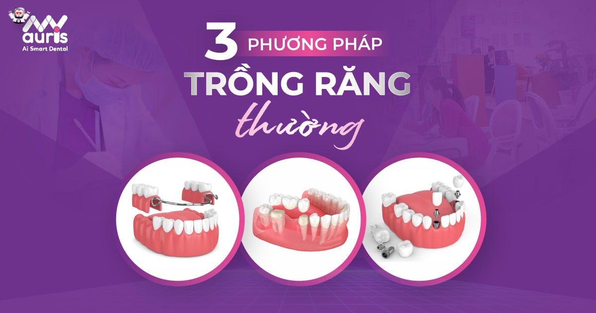 trồng răng thường