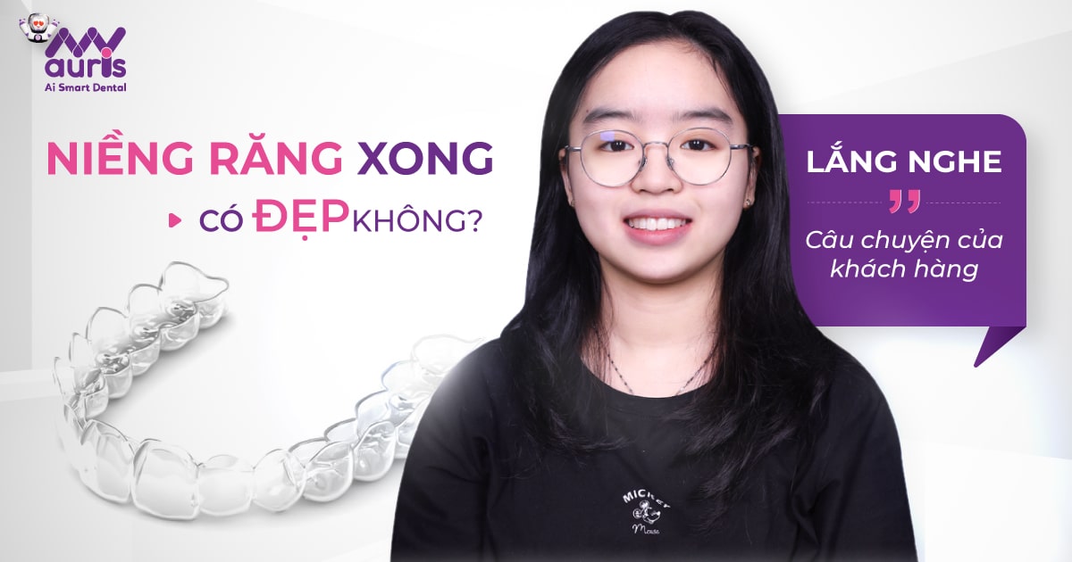 niềng răng xong có đẹp hơn không