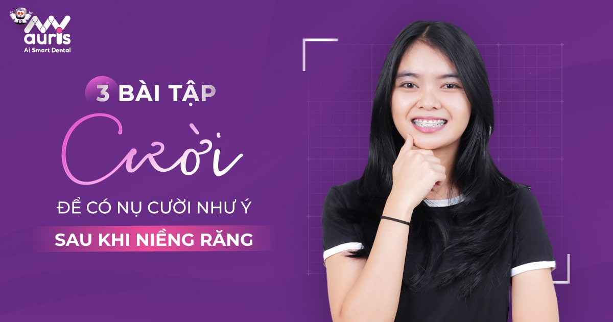 niềng răng để có nụ cười đẹp