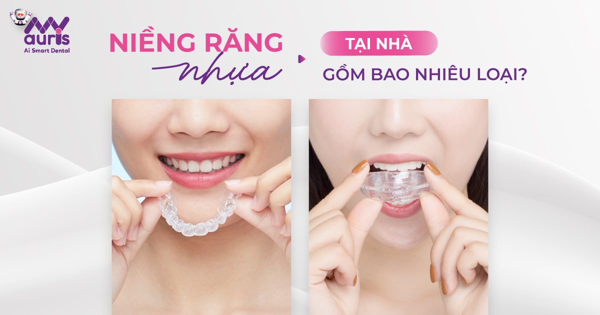 niềng răng nhựa tại nhà