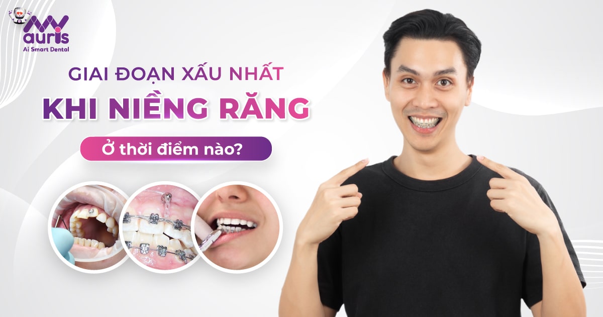 giai đoạn xấu nhất khi niềng răng