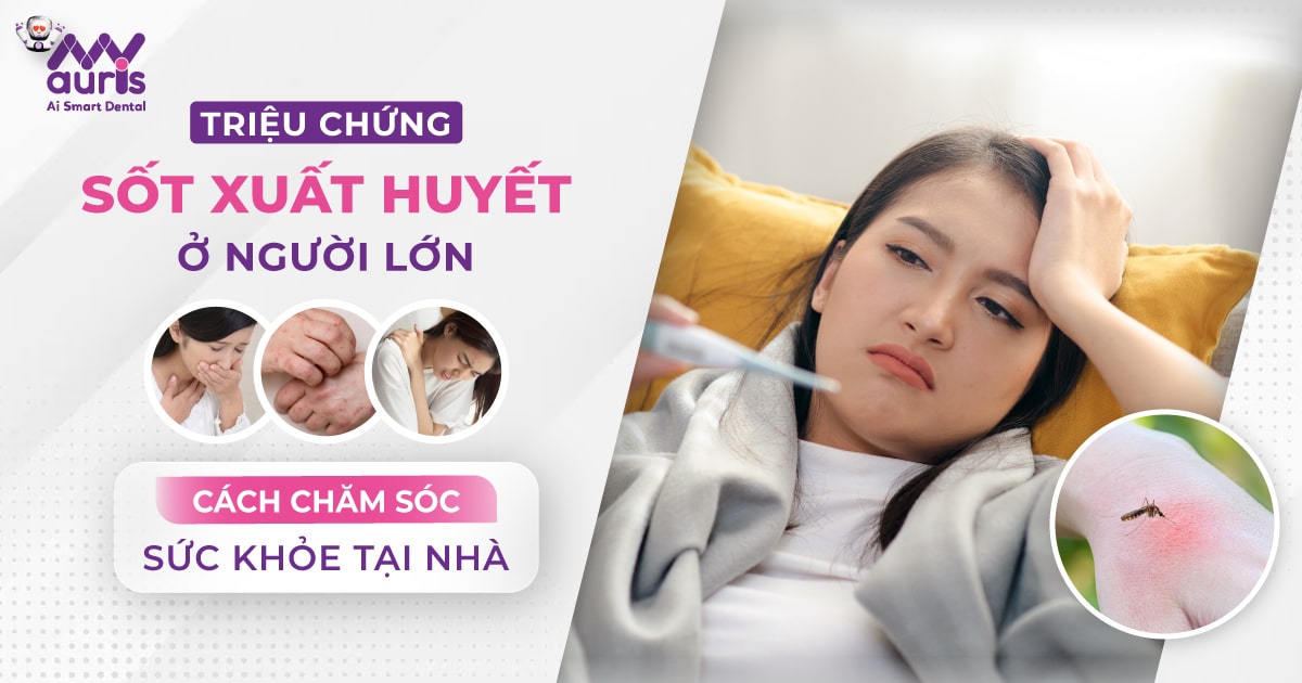 triệu chứng sốt xuất huyết ở người lớn