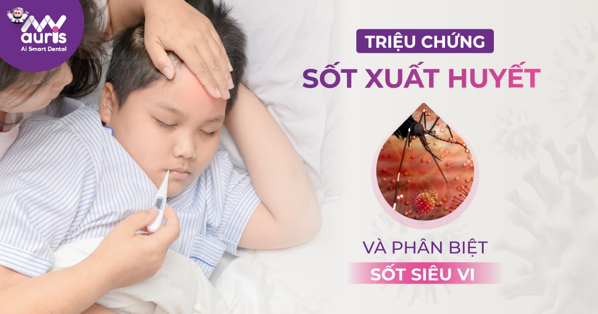 triệu chứng sốt xuất huyết ở trẻ em