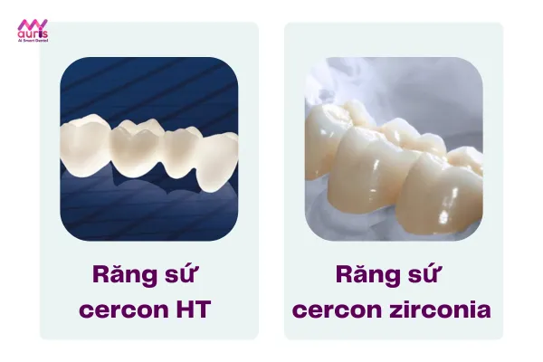 Răng sứ cercon có mấy loại? 
