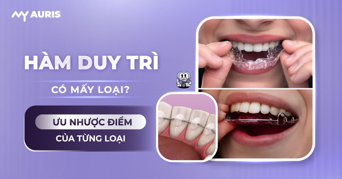 các loại hàm duy trì