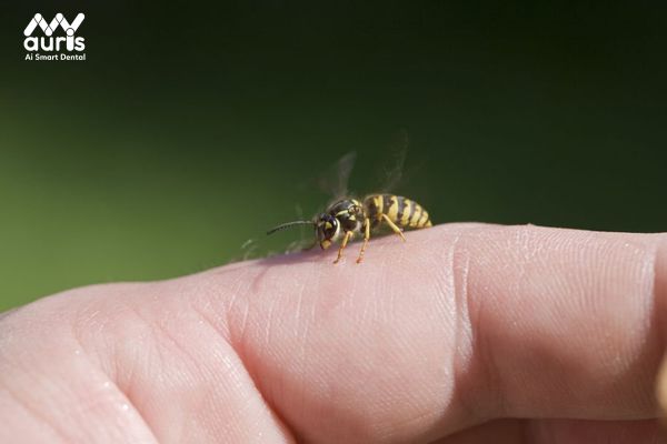 Bị ong đốt sẽ gây nên hậu quả gì?