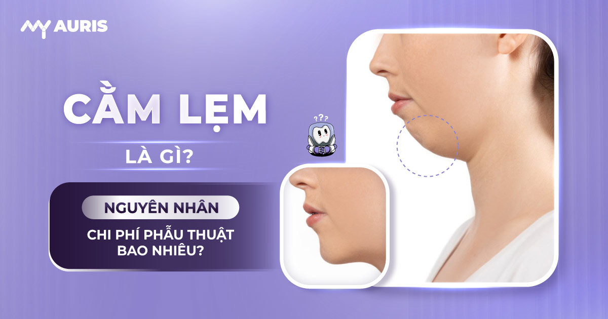 Cằm lẹm