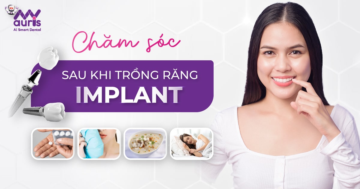 Chăm sóc răng sau khi trồng Implant - Theo 3 trường hợp