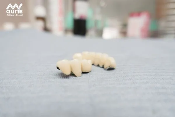 Tìm hiểu chi phí bọc răng sứ Titan 