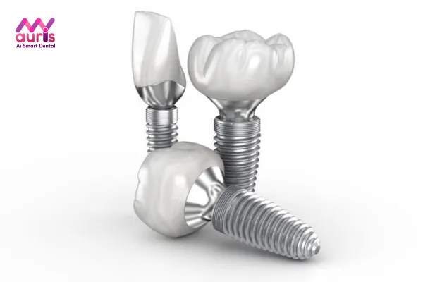 Giải đáp chi phí trồng Implant 2 răng cửa là bao nhiêu?