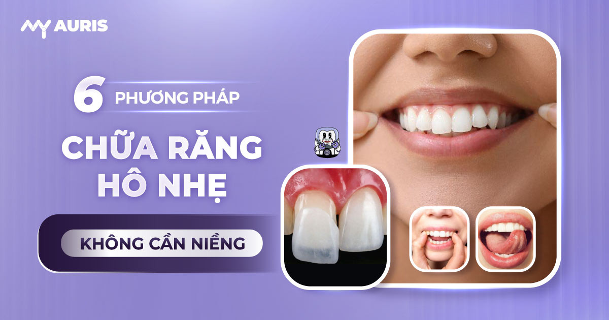 chua-rang-ho-nhe-khong-can-nieng-11-2-25