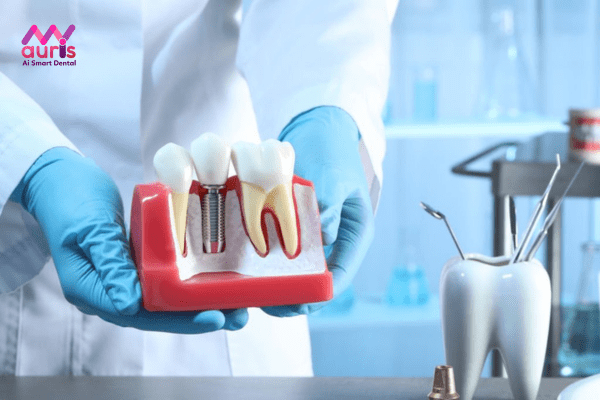 Thực hiện trồng răng Implant có tốt không?