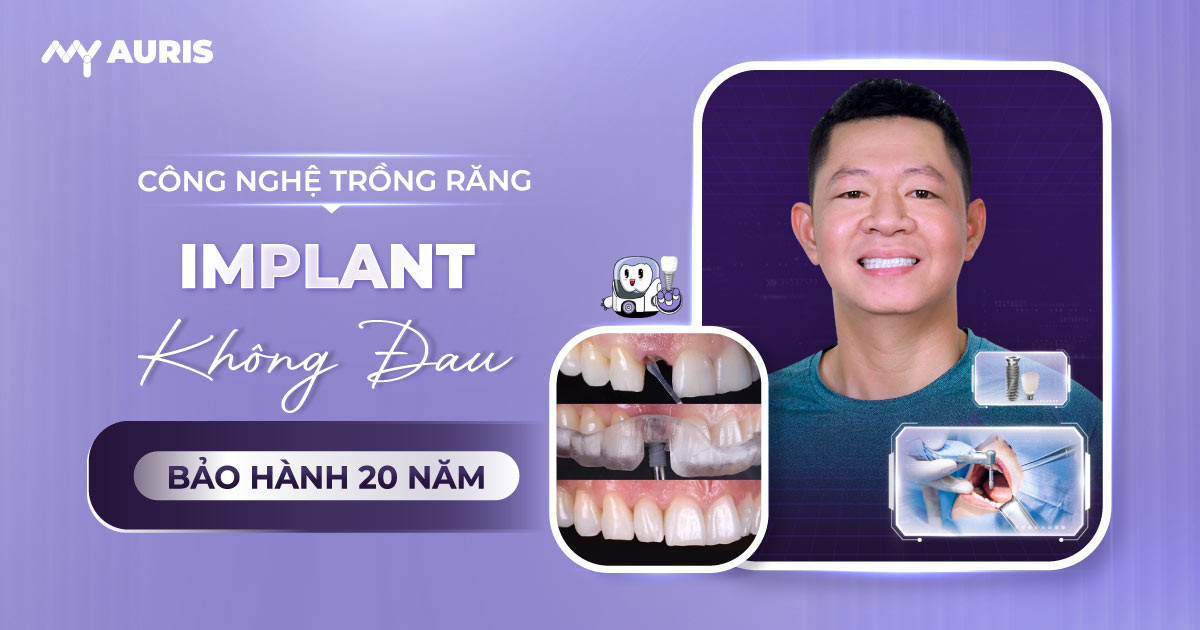 công nghệ trồng răng implant ,có ai trồng răng implant chưa,công nghệ trồng răng implant không đau,công nghệ trồng răng mới,trồng răng công nghệ implant