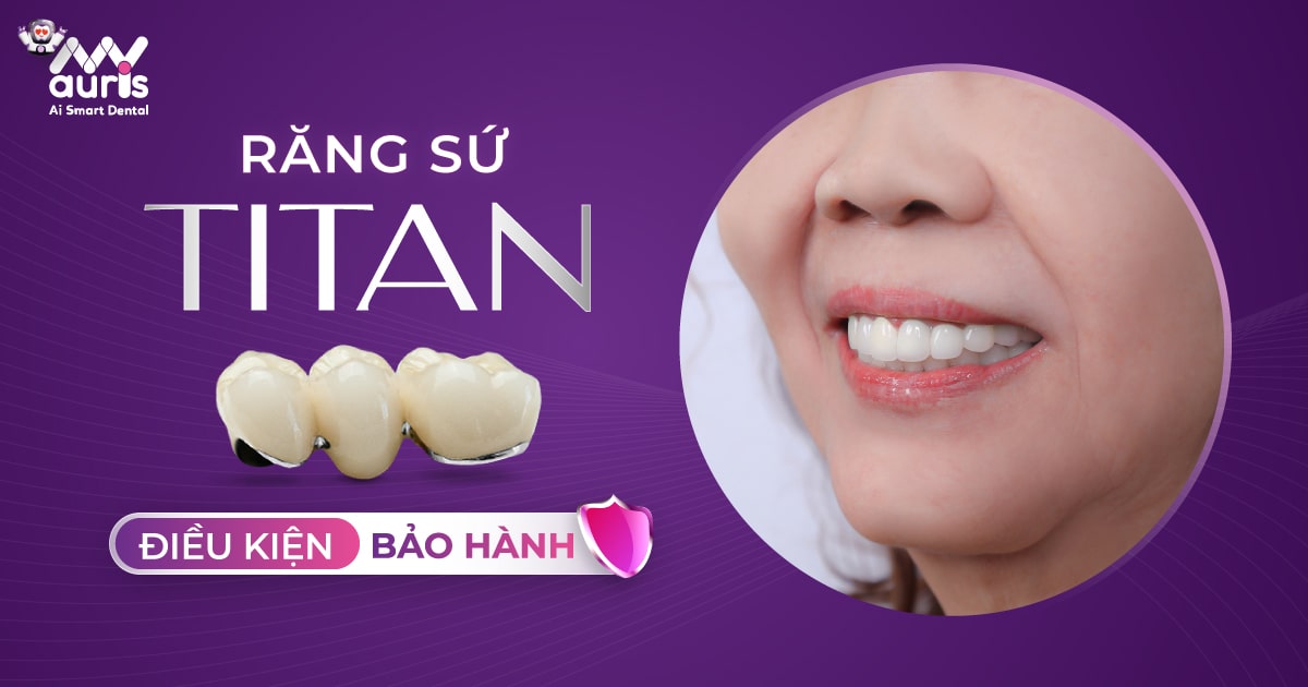 Điều kiện bảo hành răng sứ Titan (4 trường hợp chính)