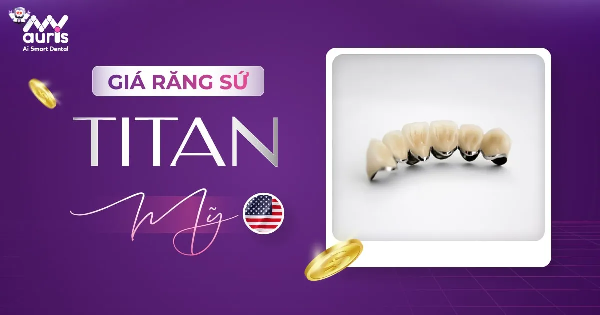 Giá răng sứ kim loại Titan của Mỹ - 5 ưu điểm nên lựa chọn