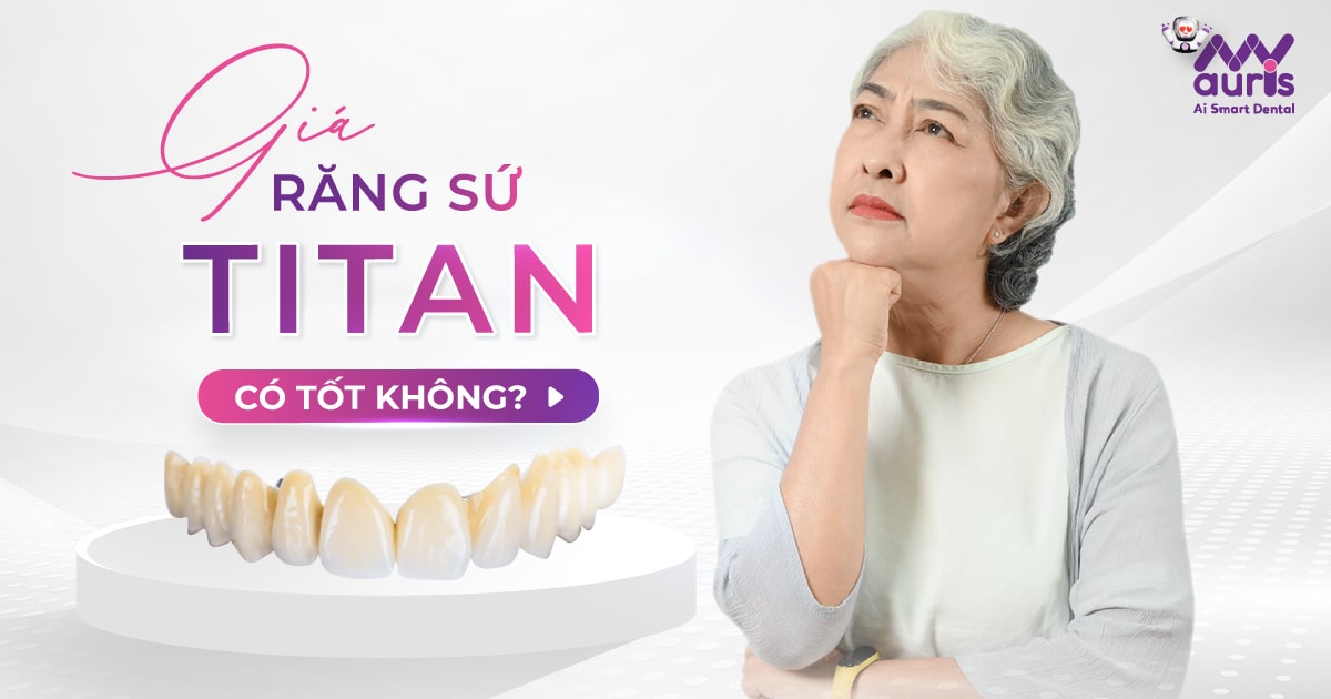 Giá răng sứ Titan có tốt không? (3 trường hợp nên làm)