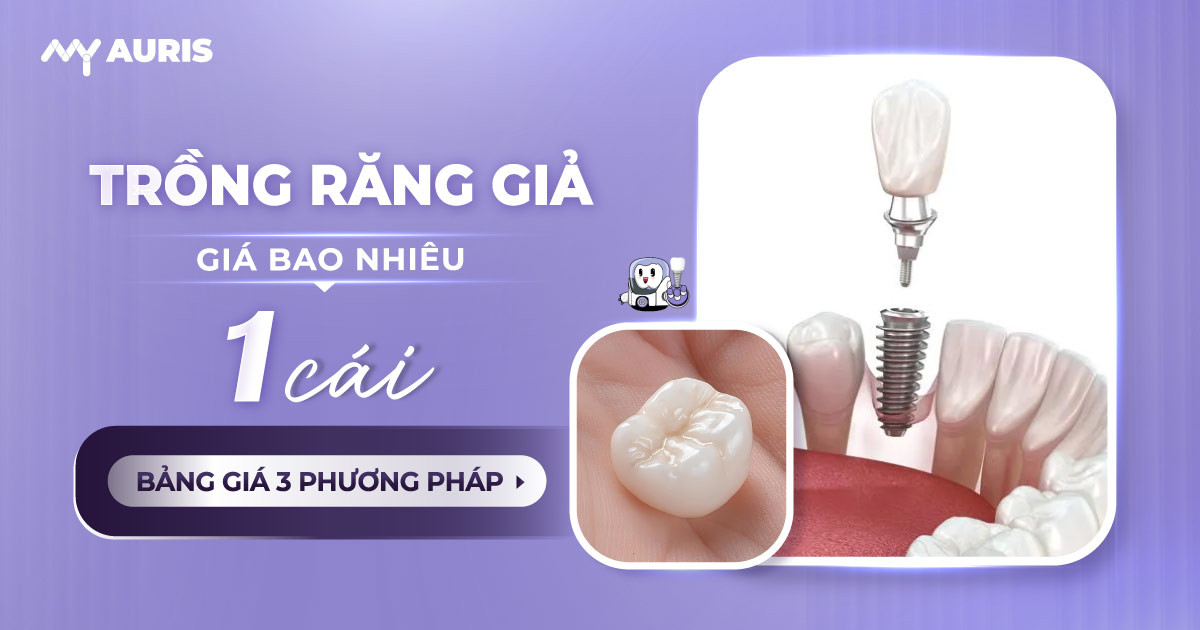 gia-trong-rang-29-3-25