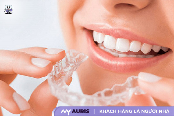hàm duy trì sau niềng răng, các loại hàm duy trì