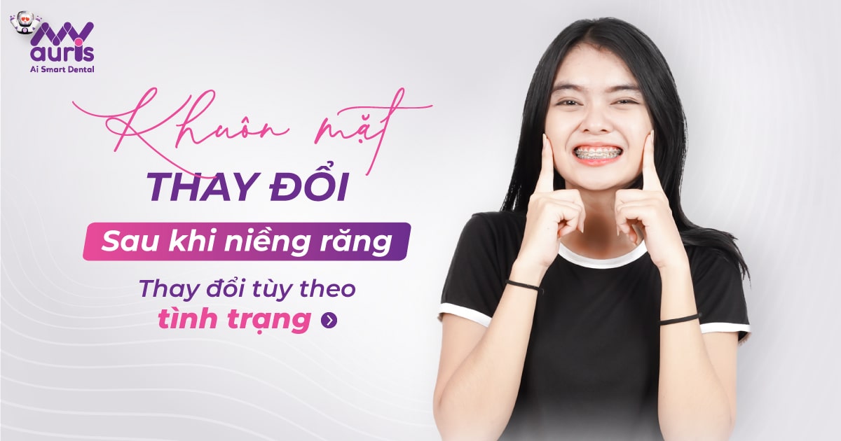 Khuôn mặt thay đổi sau khi niềng răng