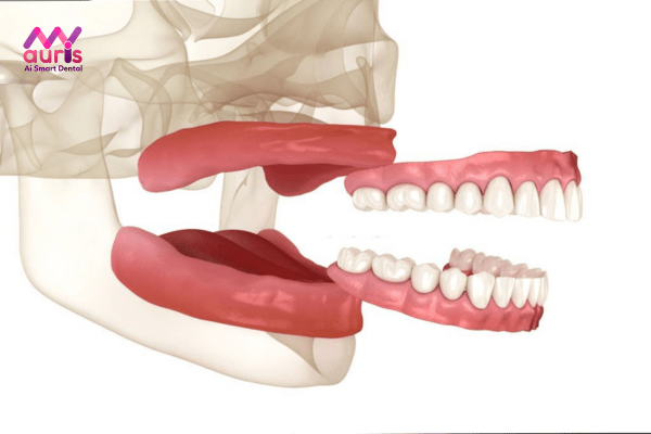 Làm răng giả nguyên hàm tháo lắp có hiệu quả không?