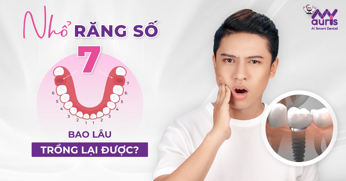 [Tư vấn] Nhổ răng số 7 bao lâu thì trồng lại được?