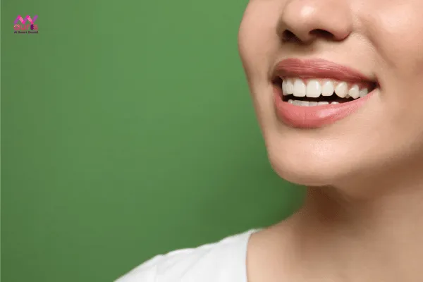 Các răng thẳng đều - những thay đổi sau khi niềng răng