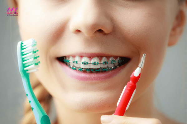 Thói quen sinh hoạt - Yếu tố ảnh hưởng đến thời gian niềng răng 