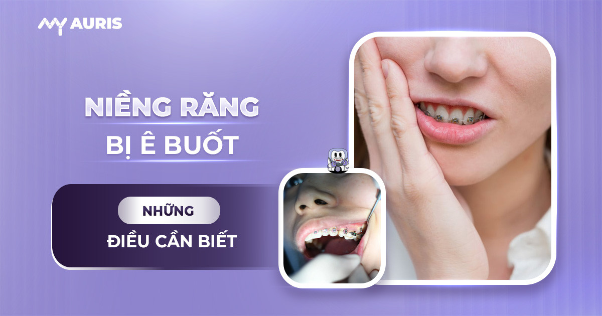 ê răng khi niềng răng,niềng răng bị buốt răng,niềng răng bị ê,niềng răng bị ê buốt