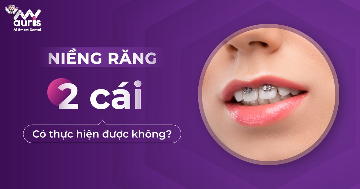 Niềng răng 2 cái có thực hiện được không?