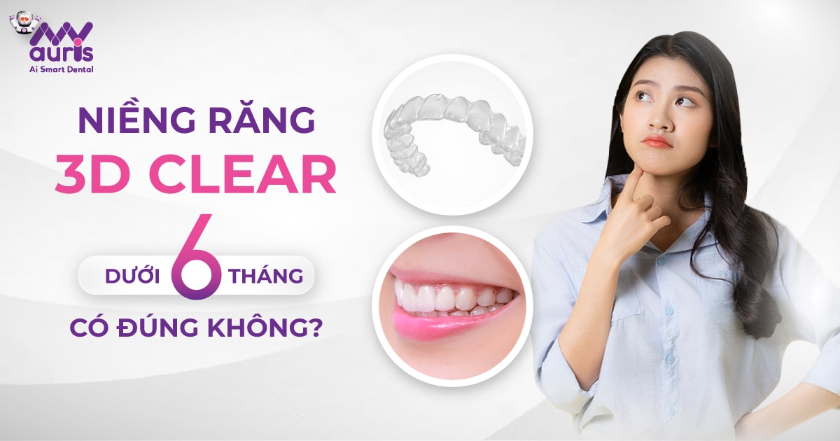 Niềng răng 3d clear dưới 6 tháng có đúng không?