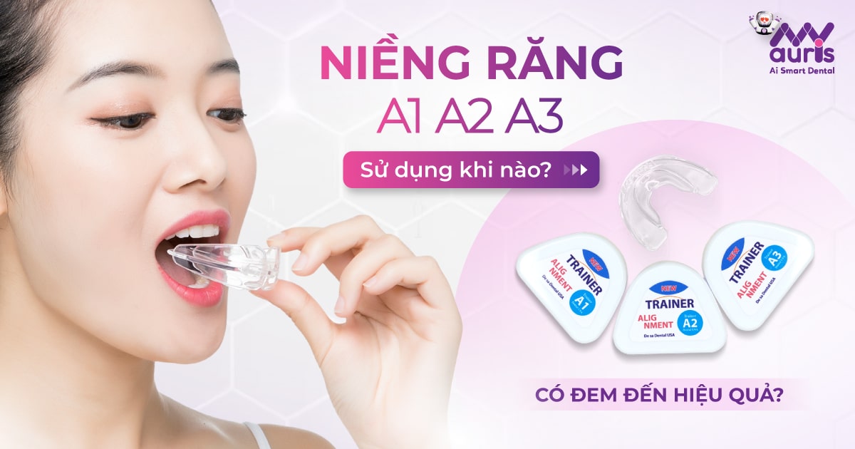 Niềng răng a1 a2 a3 sử dụng khi nào