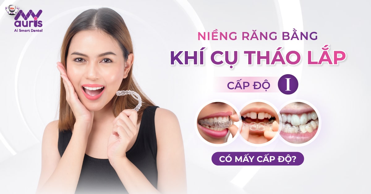 Niềng răng bằng khí cụ tháo lắp cấp độ i